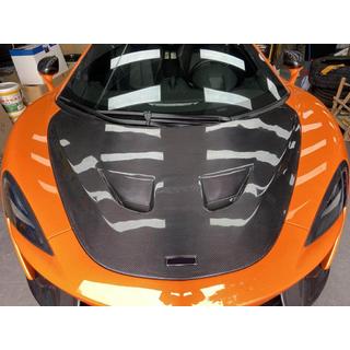 Motora pārsegs (oglekļa šķiedra) McLaren 540C/570S 2015–2020 foto 2